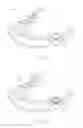 Fig. 02 - Positioning and Installing Surgical Drilling Devices and Related Devices and Systems