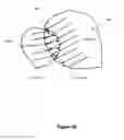 Fig. 22 - Preventing interference between tooth models
