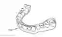 Fig. 01 - ORTHODONTIC APPLIANCE HAVING CONTINUOUS SHAPE MEMORY