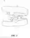 Fig. 02 - METHODS FOR MANDIBULAR JAW MANIPULATION