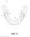 Fig. 04 - METHODS FOR MANDIBULAR JAW MANIPULATION