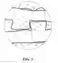 Fig. 06 - METHODS FOR MANDIBULAR JAW MANIPULATION