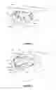 Fig. 02 - Overdenture and dental implant framework