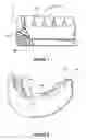 Fig. 05 - Overdenture and dental implant framework