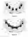 Fig. 07 - Overdenture and dental implant framework