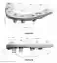 Fig. 12 - Overdenture and dental implant framework