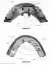 Fig. 13 - Overdenture and dental implant framework