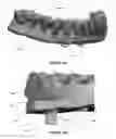 Fig. 14 - Overdenture and dental implant framework