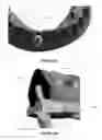 Fig. 16 - Overdenture and dental implant framework