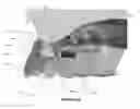 Fig. 24 - Overdenture and dental implant framework