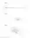 Fig. 04 - IRRIGATION CANNULA, IN PARTICULAR FOR AN ENDODONTIC IRRIGATION DEVICE