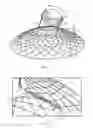 Fig. 09 - Fixation of intraluminal device