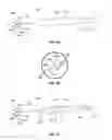 Fig. 02 - Devices and methods for implanting corneal tissue