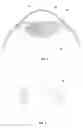 Fig. 02 - Devices for reconstruction of a lens capsule after cataract surgery