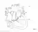 Fig. 02 - REPLACEMENT HEART VALVE SYSTEM HAVING DOCKING STATION WITH SACRIFICIAL VALVE