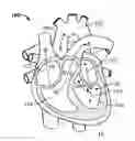 Fig. 01 - Transcatheter mitral valve design