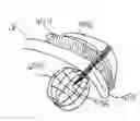 Fig. 01 - Methods, systems and devices for cardiac valve repair