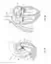 Fig. 02 - Methods, systems and devices for cardiac valve repair