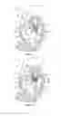 Fig. 04 - Methods, systems and devices for cardiac valve repair