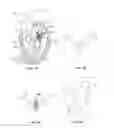 Fig. 07 - Methods, systems and devices for cardiac valve repair