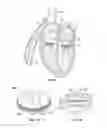 Fig. 08 - Methods, systems and devices for cardiac valve repair