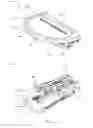 Fig. 02 - Unicompartmental knee arthroplasty
