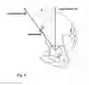 Fig. 04 - Acetabular cup prosthesis positioning instrument and method