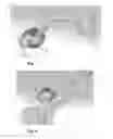 Fig. 06 - Acetabular cup prosthesis positioning instrument and method