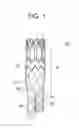 Fig. 02 - Endoprothesis delivery system