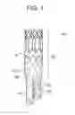 Fig. 02 - Endoprothesis delivery system