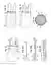 Fig. 07 - Prosthesis delivery system with axially collapsible sheath