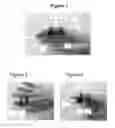 Fig. 02 - SPLINT