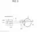 Fig. 04 - APPARATUS FOR OCULAR TREATMENT AND METHOD FOR OPERATING APPARATUS FOR OCULAR TREATMENT