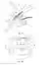 Fig. 02 - Glaucoma drainage implant