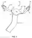 Fig. 02 - Hearing protection device
