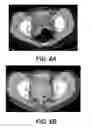 Fig. 09 - METHODS FOR TREATING CANCER