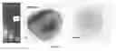 Fig. 02 - Method for poly signal activation of apoptosis of malignant solid tumour cells