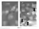 Fig. 07 - Method for poly signal activation of apoptosis of malignant solid tumour cells