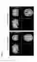 Fig. 07 - Method of using bifidobacterium longum to treat depressive symptoms