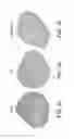 Fig. 06 - Compositions and methods for protecting the kidney from ischemia reperfusion injury