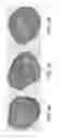 Fig. 17 - Compositions and methods for protecting the kidney from ischemia reperfusion injury