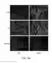 Fig. 25 - Compositions and methods for protecting the kidney from ischemia reperfusion injury