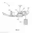 Fig. 04 - Combination wearable and stationary dialysis systems