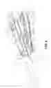 Fig. 07 - Vital sleeve