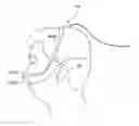 Fig. 01 - PAP system