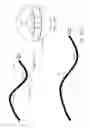 Fig. 80 - PAP system