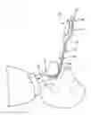Fig. 01 - Intubation stylet with video feed