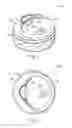 Fig. 02 - Jar sealing and unsealing device