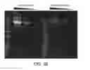 Fig. 07 - Methods for the Modulation of LGALS3BP to Treat Systemic Lupus Erythematosus