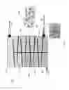 Fig. 04 - Apparatus and methods to remove solids from hydrocarbon streams